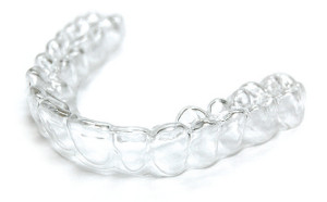 Orthodontie de l'Adulte - Illustration 2